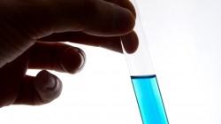 The Top 5 Killer Infectious Diseases